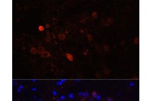 Immunofluorescence analysis of Mouse brain using CALB2 Polyclonal Antibody at dilution of 1:100. (Calretinin anticorps)