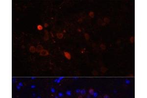 Immunofluorescence analysis of Mouse brain using CALB2 Polyclonal Antibody at dilution of 1:100. (Calretinin anticorps)