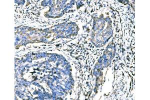 IHC analysis of ATG16L1 using anti-ATG16L1 antibody (ABIN7602244). (ATG16L1 anticorps  (AA 66-359))