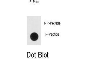 Image no. 1 for anti-Enolase 2 (Gamma, Neuronal) (ENO2) (pTyr236) antibody (ABIN358515) (ENO2/NSE anticorps  (pTyr236))