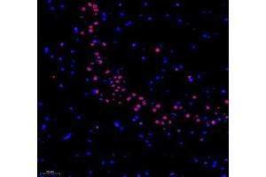 Immunofluorescence of paraffin embedded rat hippocampus using RBM8A (ABIN7075478) at dilution of 1: 300 (200x lens) (RBM8A anticorps)