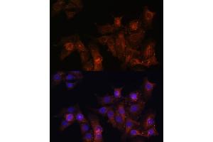 Immunohistochemistry of paraffin-embedded rat heart using Dystrophin Rabbit pAb (ABIN1679546, ABIN3015473, ABIN3015474 and ABIN6218357) at dilution of 1:25 (40x lens). (Dystrophin anticorps  (AA 346-635))