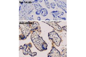 Immunohistochemistry (IHC) image for anti-Receptor tyrosine-protein kinase erbB-2 (ErbB2/Her2) (C-Term) antibody (ABIN6254225)