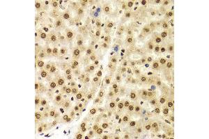 Immunohistochemistry of paraffin-embedded Rat liver using Histone H3 antibody at dilution of 1:100 (x400 lens). (Histone 3 anticorps  (C-Term))