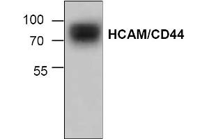 Image no. 1 for anti-CD44 (CD44) antibody (ABIN155127) (CD44 anticorps)