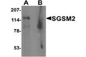 Western blot analysis of SGSM2 in human cerebellum tissue lysate with SGSM2 Antibody  at 1 μg/ml in (A) the absence and (B) the presence of blocking peptide (SGSM2 anticorps  (Middle Region))