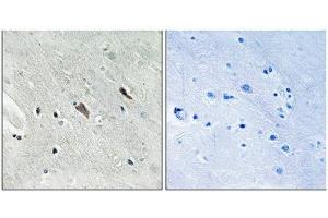 Immunohistochemical analysis of paraffin-embedded human brain tissue using Gab2 (Phospho-Tyr643) antibody (left)or the same antibody preincubated with blocking peptide (right). (GAB2 anticorps  (pTyr643))