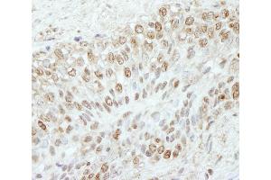 anti-WD Repeat Domain 91 (WDR91) (AA 350-400) antibody