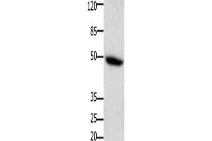Western Blotting (WB) image for anti-Colony Stimulating Factor 2 Receptor, Alpha, Low-Affinity (Granulocyte-Macrophage) (CSF2RA) antibody (ABIN2426009) (CSF2RA anticorps)