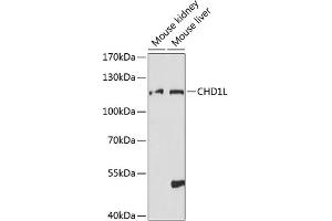 Western blot analysis of extracts of various cell lines, using CHD1L antibody (ABIN7266362) at 1:1000 dilution.