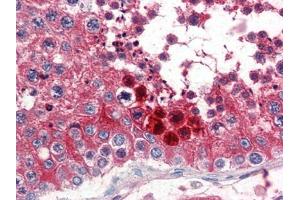 Human Testis (formalin-fixed, paraffin-embedded) stained with CLUat 2. (Clusterin anticorps  (C-Term))