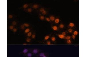 Immunofluorescence analysis of HeLa cells using WT1 Polyclonal Antibody at dilution of 1:100. (WT1 anticorps)