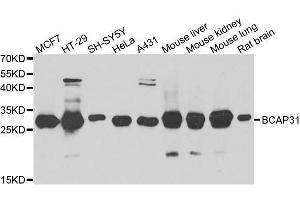 Western blot analysis of extracts of various cell lines, using BCAP31 antibody. (BCAP31 anticorps  (AA 127-246))
