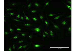 Immunofluorescence of purified MaxPab antibody to ATOH7 on HeLa cell. (ATOH7 anticorps  (AA 1-152))