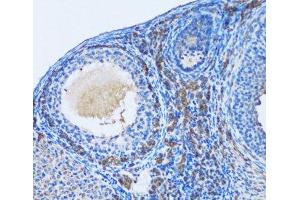 Immunohistochemistry of paraffin-embedded Rat ovary using OGDH Polyclonal Antibody at dilution of 1:100 (20x lens). (alpha KGDHC anticorps)