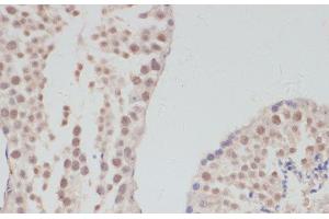 Immunohistochemistry of paraffin-embedded Mouse testis using CCNG1 Polyclonal Antibody at dilution of 1:100 (40x lens). (Cyclin G1 anticorps)