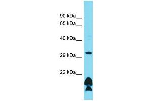Host: Rabbit Target Name: OR51B5 Sample Type: HCT15 Whole Cell lysates Antibody Dilution: 1. (OR51B5 anticorps  (C-Term))