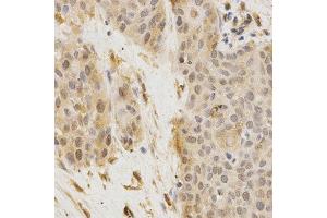 Immunohistochemistry (IHC) image for anti-Golgi-Associated, gamma Adaptin Ear Containing, ARF Binding Protein 2 (GGA2) (AA 1-300) antibody (ABIN3021665)