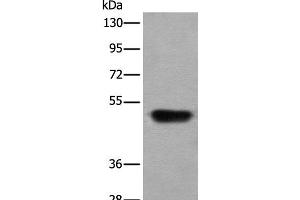 Western blot analysis of Human fetal liver tissue lysate using HNRNPH2 Polyclonal Antibody at dilution of 1:400 (HNRNPH2 anticorps)