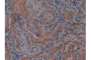 Used in DAB staining on fromalin fixed paraffin-embedded Kidney tissue (PAI1 anticorps  (AA 25-402))