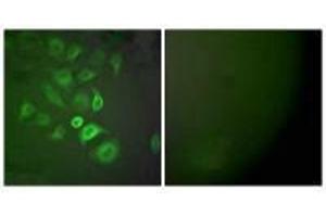 Immunofluorescence analysis of A549 cells, using S100 A1 antibody. (S100A1 anticorps)