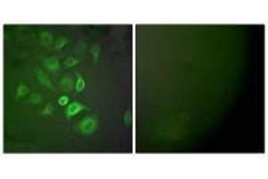 Immunofluorescence analysis of A549 cells, using S100 A1 antibody. (S1A1 anticorps)