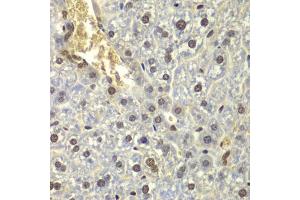 Immunohistochemistry of paraffin-embedded mouse liver using RPL5 antibody (ABIN3015785, ABIN3015786, ABIN3015787 and ABIN6219135) at dilution of 1:200 (40x lens). (RPL5 anticorps  (AA 1-95))