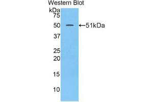 Western blot analysis of the recombinant protein. (LAMC2 anticorps  (AA 972-1191))