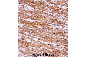 Mouse Nek6 Antibody (C-term) ((ABIN657847 and ABIN2846808))immunohistochemistry analysis in formalin fixed and paraffin embedded mouse heart tissue followed by peroxidase conjugation of the secondary antibody and DAB staining. (NEK6 anticorps  (C-Term))