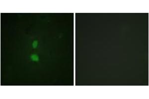 Immunofluorescence analysis of HuvEc cells, using SNAI1 (Phospho-Ser246) Antibody. (SNAIL anticorps  (pSer246))