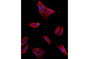 ABIN6261694 and ABIN6273243 staining Hela by IF/ICC.