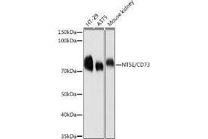 Western blot analysis of extracts of various cell lines, using CD73/NT5E antibody (ABIN3022733, ABIN3022734, ABIN3022735, ABIN1513283 and ABIN6219201) at 1:1000 dilution.
