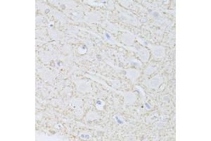 Immunohistochemistry of paraffin-embedded rat brain using PHGDH antibody (ABIN5998506) at dilution of 1/100 (40x lens). (PHGDH anticorps)