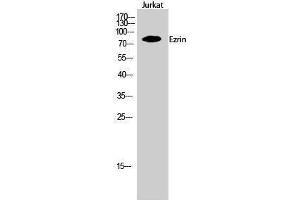 Western Blotting (WB) image for anti-Ezrin (EZR) (Tyr315) antibody (ABIN3175040) (Ezrin anticorps  (Tyr315))