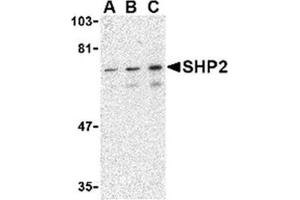 Image no. 1 for anti-Protein tyrosine Phosphatase, Non-Receptor Type 11 (PTPN11) (C-Term) antibody (ABIN318781) (PTPN11 anticorps  (C-Term))