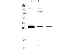 Western blot analysis of TWEAK using anti-TWEAK antibody . (TWEAK anticorps  (AA 94-249))