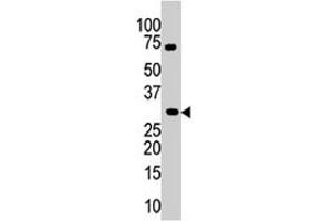 The PIM3 polyclonal antibody  is used in Western blot to detect PIM3 in mouse kidney tissue lysate. (PIM3 anticorps  (C-Term))