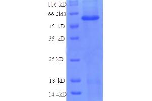 SDS-PAGE (SDS) image for Angiopoietin 2 (ANGPT2) (AA 19-485), (partial) protein (His tag) (ABIN5712419)