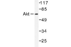 Image no. 1 for anti-V-Akt Murine Thymoma Viral Oncogene Homolog 1 (AKT1) antibody (ABIN265302) (AKT1 anticorps)