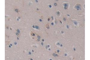 Detection of PTI in Human Cerebrum Tissue using Polyclonal Antibody to Placental Thrombin Inhibitor (PTI)