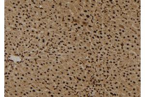 ABIN6272294 at 1/100 staining Mouse liver tissue by IHC-P. (EPS8-Like 3 anticorps)