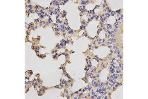 Immunohistochemistry of paraffin-embedded mouse lung using PRKACB antibody (ABIN5973065) at dilution of 1/200 (40x lens). (PRKACB anticorps)