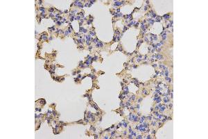Immunohistochemistry of paraffin-embedded mouse lung using PRKACB antibody (ABIN5973065) at dilution of 1/200 (40x lens).