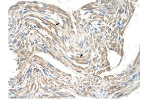 CKMT2 antibody was used for immunohistochemistry at a concentration of 4-8 ug/ml to stain Skeletal muscle cells (arrows) in Human Muscle. (CKMT2 anticorps)