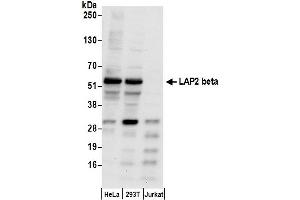 Western Blotting (WB) image for anti-LAP2 beta gamma/tmpo (AA 350-400) antibody (ABIN7455057) (LAP2 beta gamma/tmpo (AA 350-400) anticorps)