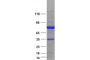 Validation with Western Blot (ESRRA Protein (Myc-DYKDDDDK Tag))