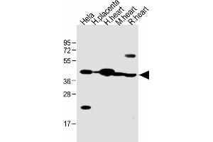 All lanes : Anti-FSTL1 Antibody (C-term) at 1:1000 dilution Lane 1: Hela whole cell lysate Lane 2: human placenta lysate Lane 3: human heart lysate Lane 4: mouse heart lysate Lane 5: rat heart lysate Lysates/proteins at 20 μg per lane.