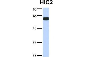 Host:  Rabbit  Target Name:  HIC2  Sample Type:  Human Fetal Brain  Antibody Dilution:  1. (HIC2 anticorps  (Middle Region))