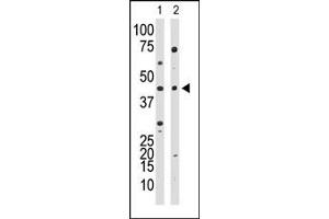 Western Blotting (WB) image for anti-YY1 Transcription Factor (YY1) (Middle Region) antibody (ABIN357757) (YY1 anticorps  (Middle Region))