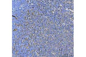 IHC analysis of SAMSN1 using anti-SAMSN1 antibody (ABIN7602721).